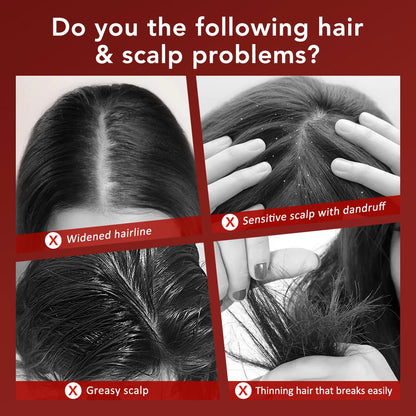 Elektrisk hårbottenmassagekam Hårväxtterapi Mikroström Rött och Blått Ljus Anti-Håravfallsbehandling Oljeapplikator